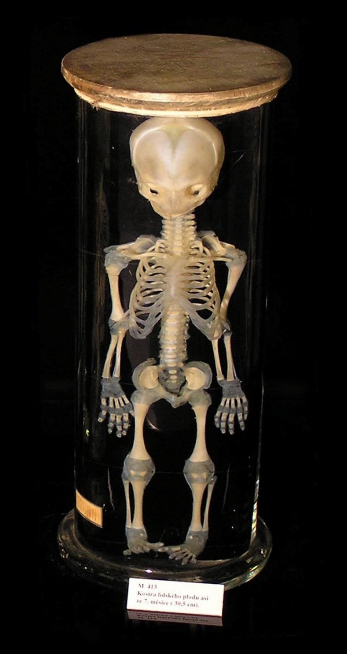 Vypreparovaný skelet asi pětiměsíčního plodu