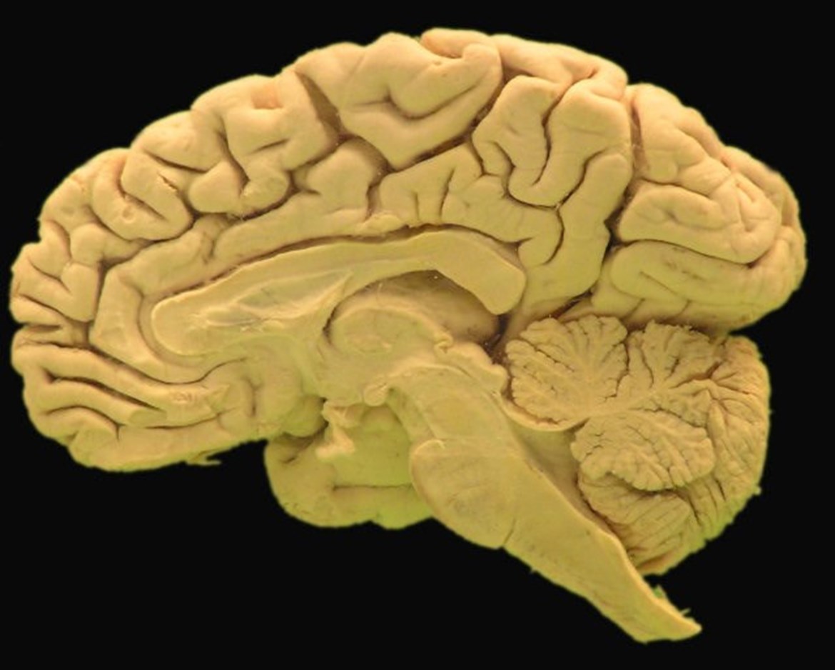 Vnitřní plocha mozkové hemisféry pravé strany dospělého jedince