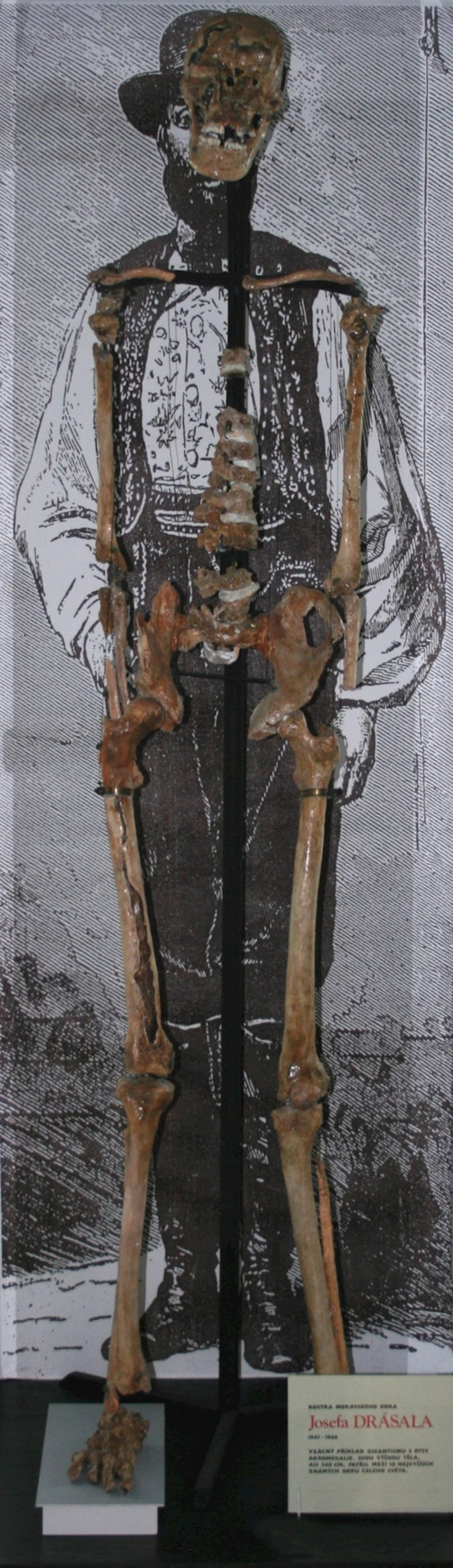 Kopie kostry moravského obra Josefa Drásala (výška 240 cm)