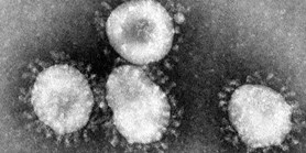 Koronavirus: Aktuální informace, návody a&#160;doporučení