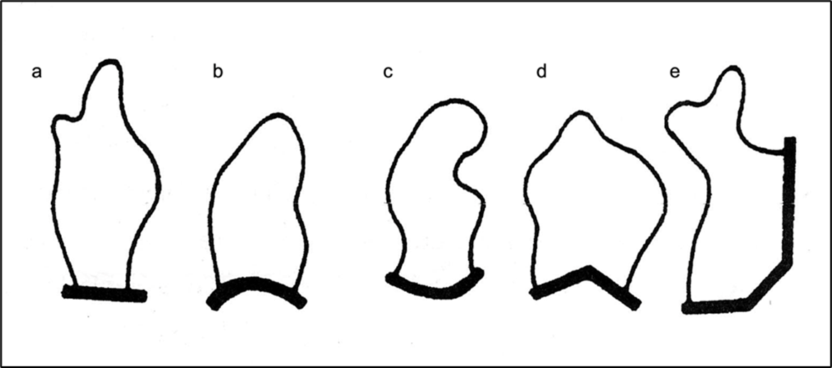 Půdorysný tvar hrází a) čelní přímá, b) čelní vypouklá, c) čelní vydutá, d) čelní lomená, e) nepravidelná (Vrána – Beran 2005, 44, obr. 5.4)