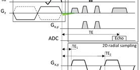 Simple compensation method for improved half-pulse excitation profile with rephasing gradient 