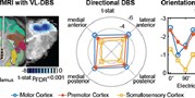 Orientation-selective and directional deep brain stimulation in swine assessed by functional MRI at 3T