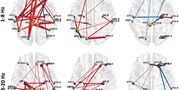 Cognitive task-related functional connectivity alterations in temporal lobe epilepsy 