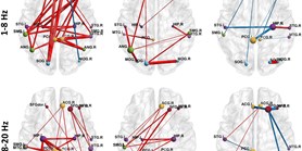 Cognitive task-related functional connectivity alterations in temporal lobe epilepsy 