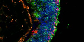 Looking for PhD candidate in the field of Retinal Organoids