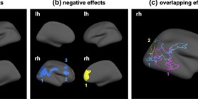 Temporally and sex-specific effects of maternal perinatal stress on offspring cortical gyrification and mood in young adulthood