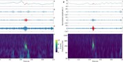 High frequency oscillations in epileptic and non-epileptic human hippocampus during a&#160;cognitive task