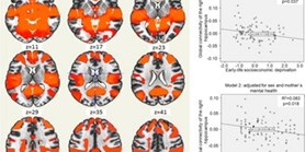 Socioeconomic deprivation in early life and symptoms of depression and anxiety in young adulthood: mediating role of hippocampal connectivity
