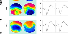 Imitation or Polarity Correspondence? Behavioural and Neurophysiological Evidence for the Confounding Influence of Orthogonal Spatial Compatibility on Measures of Automatic Imitation 