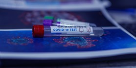 Laboratoře mají až šestkrát víc zájemců o&#160;testy na protilátky na covid