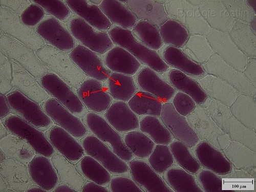 Pokožka suknice cibule kuchyňské v 0.4 M sacharóze. Popis: bs - buněčná stěna, pl - plazmalema, v - vakuola.