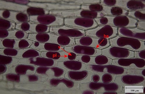 Pokožka suknice cibule kuchyňské v 0.8 M sacharóze. Popis: bs - buněčná stěna, pl - plazmalema, v - vakuola.
