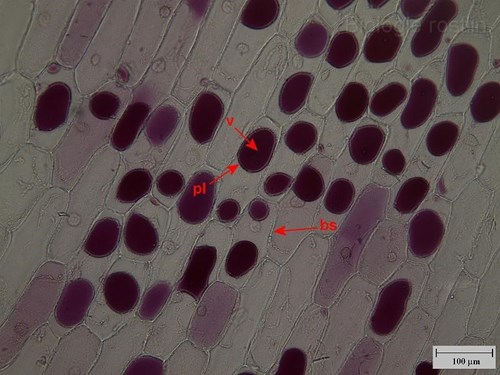 Pokožka suknice cibule kuchyňské v 0.8 M sacharóze. Popis: bs - buněčná stěna, pl - plazmalema, v - vakuola.