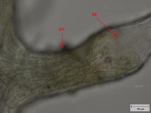 Detail bazální části žahavého trichomu kopřivy. Popis: bt - báze trichomu, en - emergenční nástavec.
