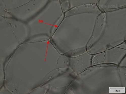 Parenchymatické buňky dřeně bezu černého. Popis: bs - buněčná stěna, i - intercelulára