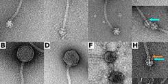 Staphylococcus epidermidis Phages Transduce Antimicrobial Resistance Plasmids and Mobilize Chromosomal Islands