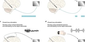 Electrophysiological biomarkers for deep brain stimulation outcomes in movement disorders: state of the art and future challenges 