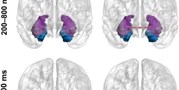 Memory retrieval in temporal lobe epilepsy is related to functional segregation of the mesiotemporal structures 