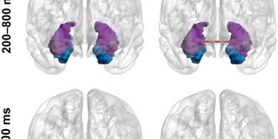 Memory retrieval in temporal lobe epilepsy is related to functional segregation of the mesiotemporal structures 