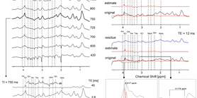 In vivo macromolecule signals in rat brain 1 H-MR spectra at 9.4T: Parametrization, spline baseline estimation, and T 2 relaxation times 