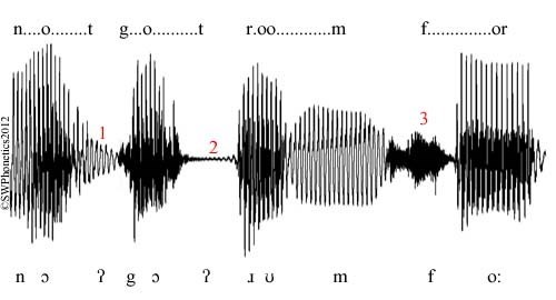 Z kapitoly o hardware víš, že zvuk je vlnění vzduchu. Nahrávka řeči je vlastně informace o délce a výšce těchto vln (což odpovídá výšce zvuku a hlasitosti). Stejné fonémy mají podobný tvar, i když je vyslovují různí lidé. Program pro rozpoznání hlasu hledá fonémy podle této podobnosti.