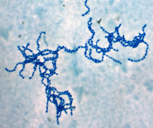 Streptococcus pyogenes v optickém mikroskopu, grampozitivní koky v řetízcích