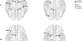 Cortical network organization reflects clinical response to subthalamic nucleus deep brain stimulation in Parkinson's&#160;disease