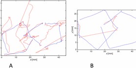 Shannon entropy: A&#160;novel parameter for quantifying pentagon copying performance in non-demented Parkinson's&#160;disease patients