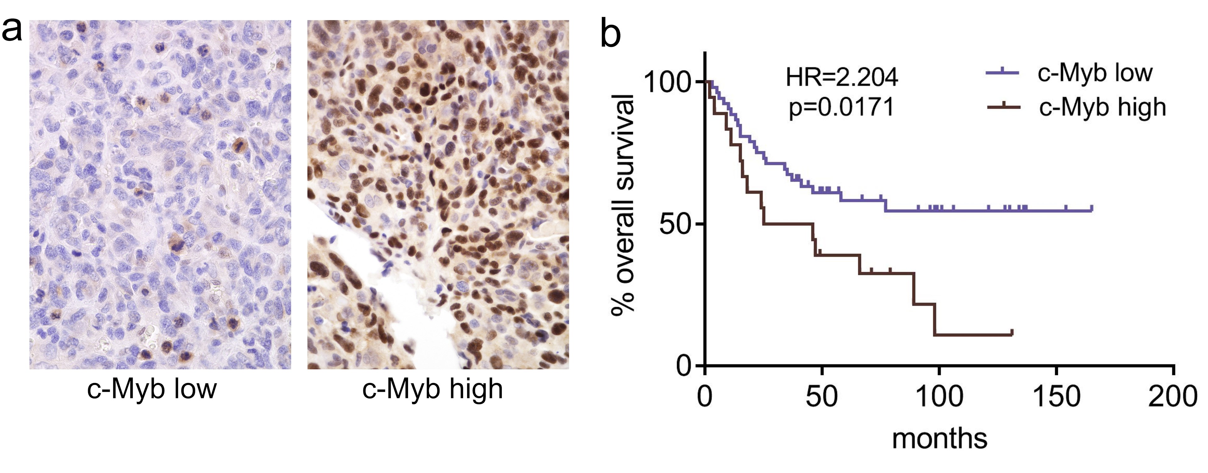 New paper in Clinical and Experimental Metastasis