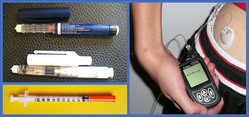 Různé způsoby jak lze aplikovat inzulin. S pomocí inzulinky, inzulinového pera nebo pomocí inzulinové pumpy.