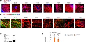 Clozapine Reverses Dysfunction of Glutamatergic Neurons Derived From Clozapine-Responsive Schizophrenia Patients