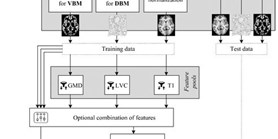 Structural MRI-Based Schizophrenia Classification Using Autoencoders and 3D Convolutional Neural Networks in Combination with Various Pre-Processing Techniques