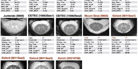 Comparison of multicenter MRI protocols for visualizing the spinal cord gray matter