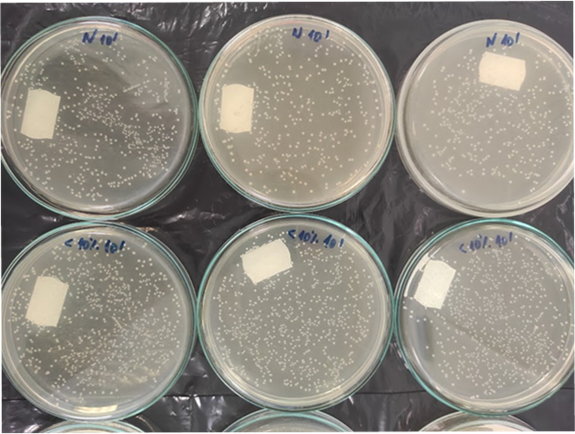 Petriho misky používané pro zjištění míry množení vybraných bakterií ve vzorcích