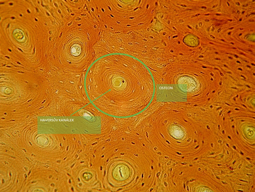 Hutná kostní tkáň pod světelným mikroskopem. Je vidět několik osteonů s centrálními kanálky kolem kterých jsou soustředné lamely. Mezi osteony jsou zbytky předchozích osteonů, tzv. vmezeřené lamely.