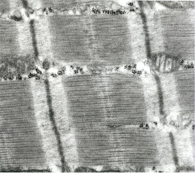 Buňka srdeční svaloviny v TEM. Zvětšeno více než 40 000x. Viditelné v textu popsané proužky, jednotlivé myofialmenta a mitochondrie.