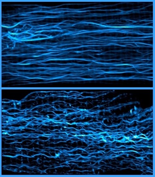 Mikrotubuly ve svalovině srdeční