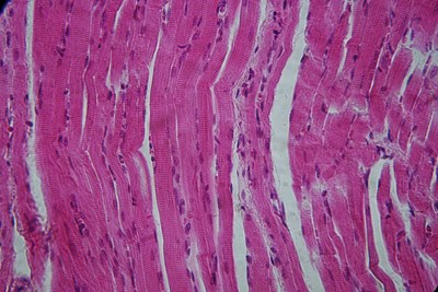  Svaly jazyka pod světelným mikroskopem, zvětšeno 400x. Vidíme svalová vlákna uložená podélně i příčně. Znatelná jsou jádra buněk.