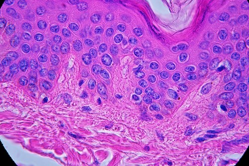 Zárodečné buňky pokožky (fialová jádra buněk) s viditelnými zrníčky pigmentu melaninu. Zvětšeno ve světelném mikroskopu 1000x.