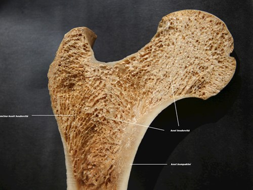 Podélný řez horním koncem kosti stehenní. Trámce kosti houbovité se tvoří podle směru tlaku a tahu na kost. Tvoří tzv. architektoniku kosti.
