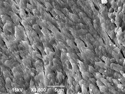 Hutná kost lidského žebra na lomu zvětšená 3500x v elektronovém mikroskopu.