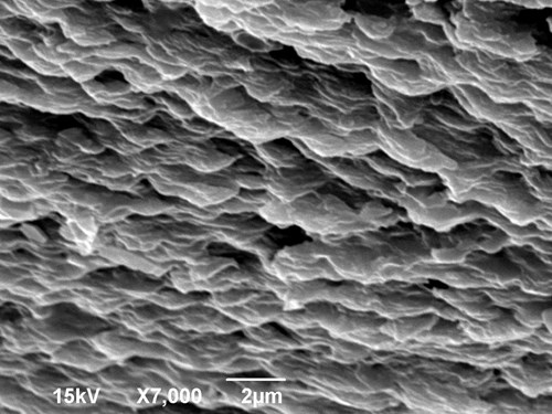 Hutná kost lidského žebra na povrchu zvětšená 7000x v elektronovém mikroskopu.