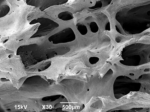 Houbovitá kost v lidském žebru zvětšená 30x v elektronovém mikroskopu.
