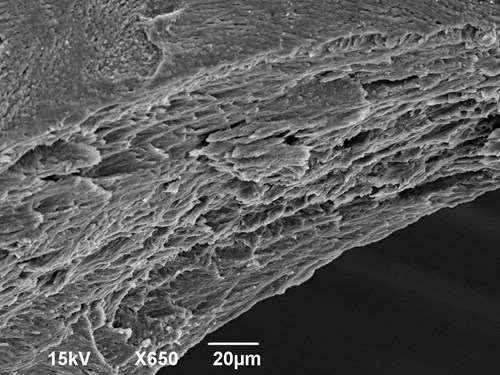 Hutná kost lidského žebra na podélném lomu zvětšená 650x v elektronovém mikroskopu.