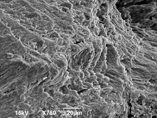 Hutná kost lidského žebra na příčném lomu zvětšená 750x v elektronovém mikroskopu.