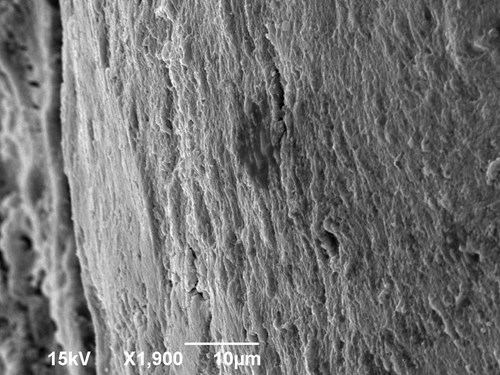 Hutná kost lidského žebra na povrchu zvětšená 1900x v elektronovém mikroskopu.