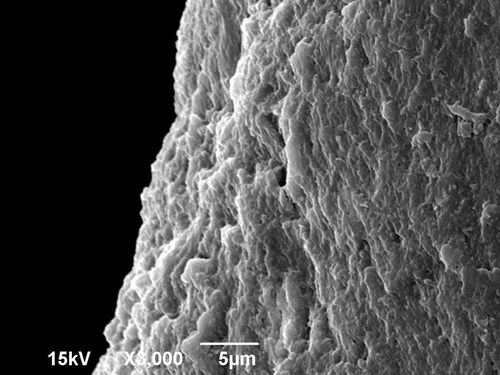 Hutná kost lidského žebra na povrchu zvětšená 3000x v elektronovém mikroskopu.