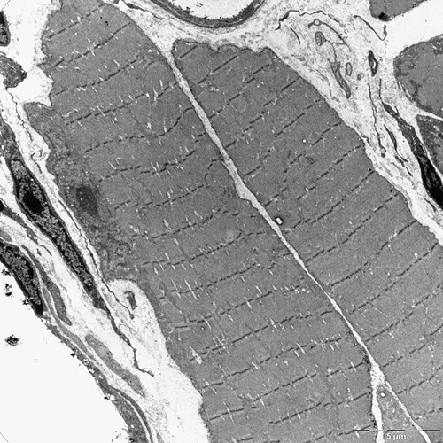 Příčně pruhovaný sval pod transmisním elektronovým mikroskopem (TEM) zvětšený 3500x. Jasně viditelné Z linie.