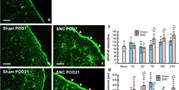 Astrocyte reactivity in the glia limitans superficialis of the rat medial prefrontal cortex following sciatic nerve injury